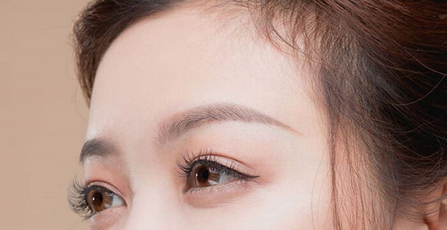 Chị em không cần kiêng khem quá nhiều trước khi cắt mí
