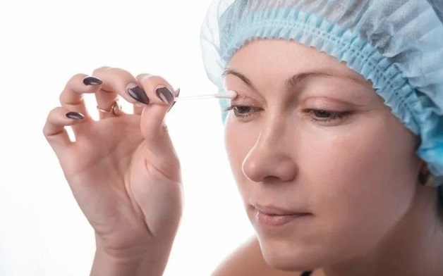 Minh có thể bôi kem trị sẹo sau khi cắt mí từ 5 - 7 ngày