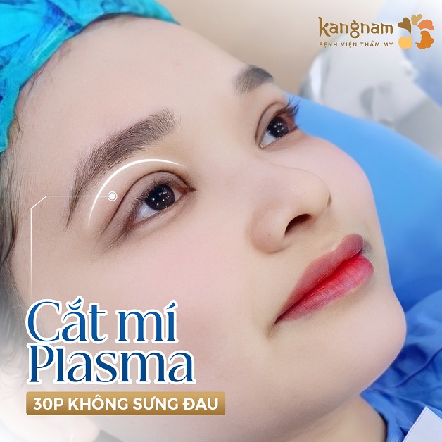 Cắt mí Hàn Quốc Plasma tạo nếp mí tự nhiên, sắc nét